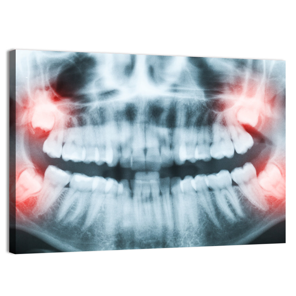 Dental X-ray Radiograph Wall Art, canvas print, landscape