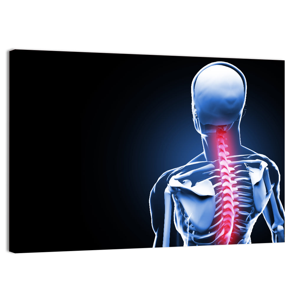 Spine Pain Anatomy Illustration Wall Art, canvas print, landscape