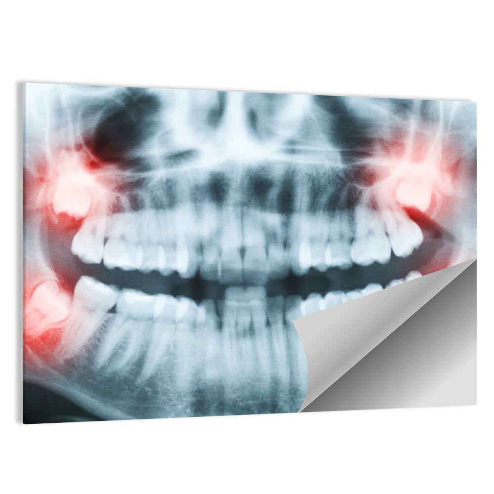 Dental X-ray Radiograph Wall Art