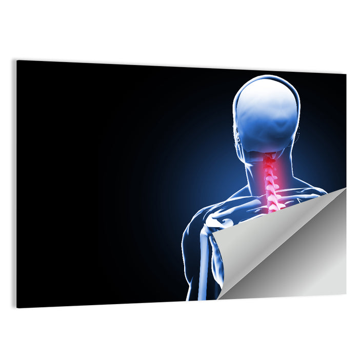 Spine Pain Anatomy Illustration Wall Art as a poster print