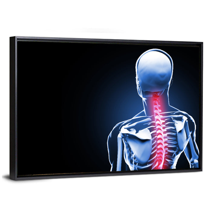 Spine Pain Anatomy Illustration Wall Art as a framed canvas
