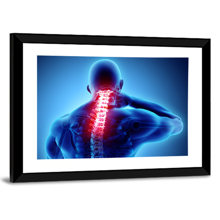 Cervical Spine X-ray Illustration Wall Art as a framed print
