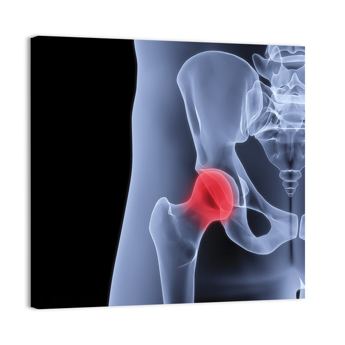 Lateral Hip Joint X-ray Wall Art as a canvas print