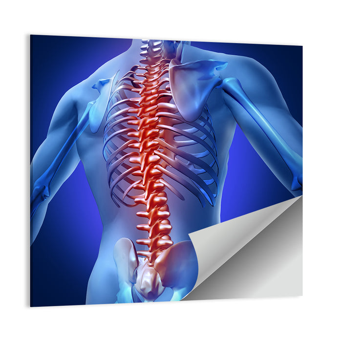 Spine Pain Anatomy Illustration Wall Art as a poster print