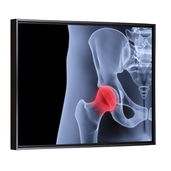 Lateral Hip Joint X-ray Wall Art as a framed canvas