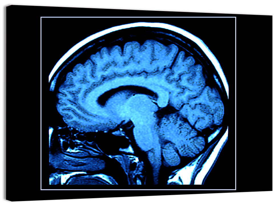 Sagittal Brain Mri Scan in Blue Wall Art, canvas print, landscape