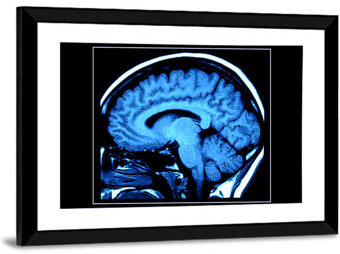 Sagittal Brain Mri Scan in Blue Wall Art as a framed print
