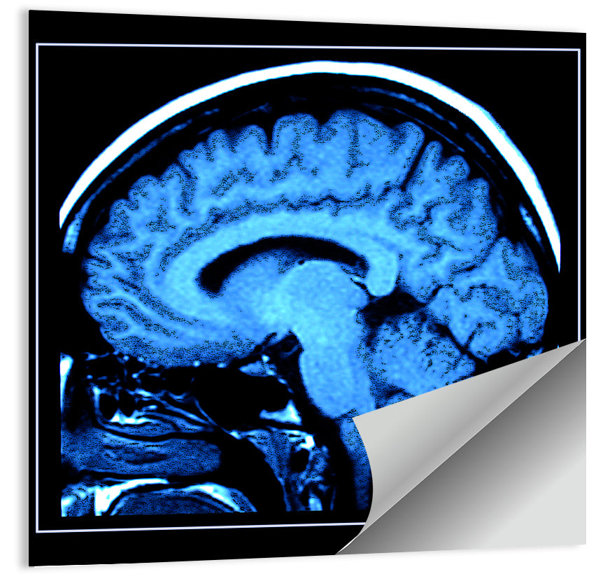 Sagittal Brain Mri Scan in Blue Wall Art