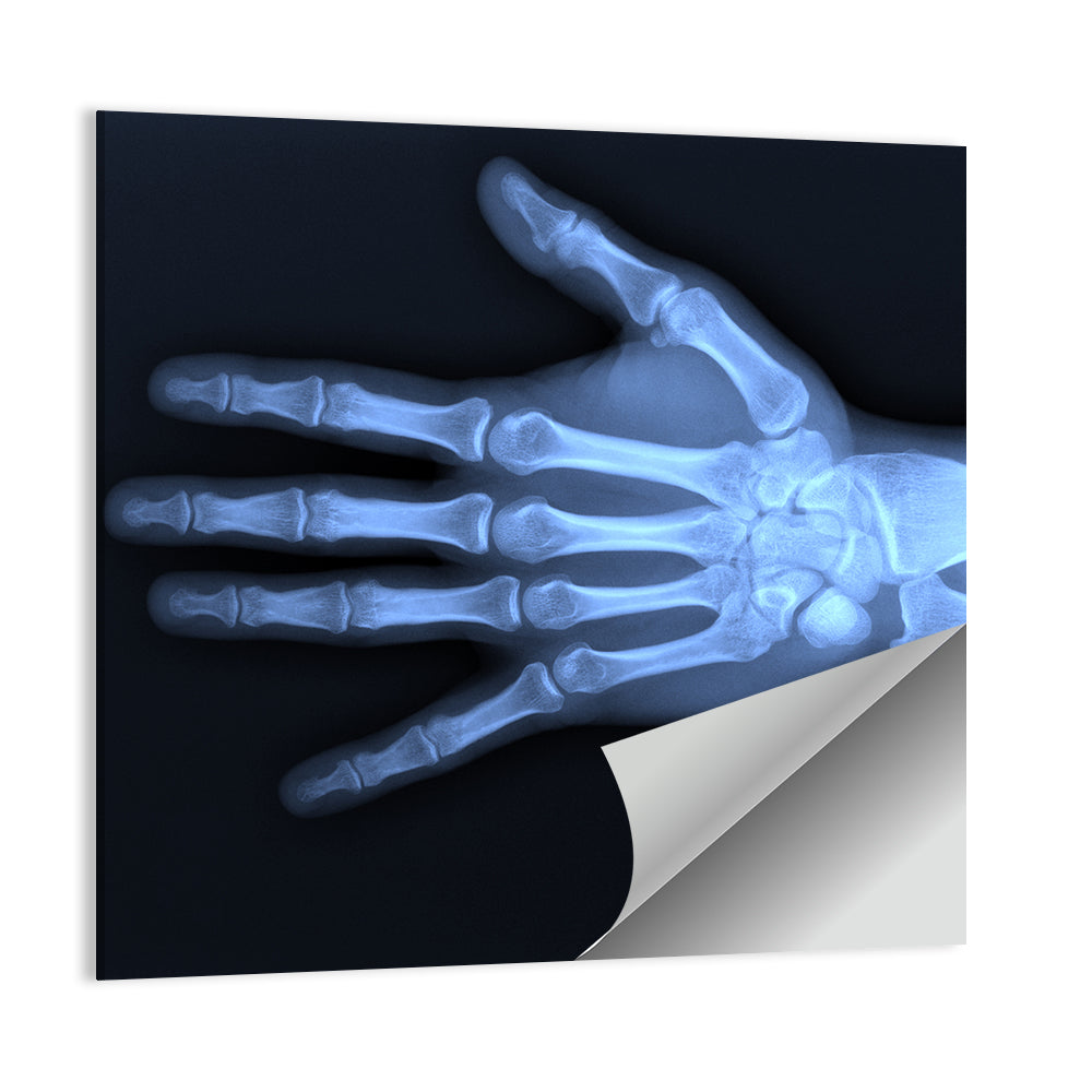 Blue Hand Radiograph Wall Art