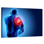 Shoulder Pain X-ray Wall Art