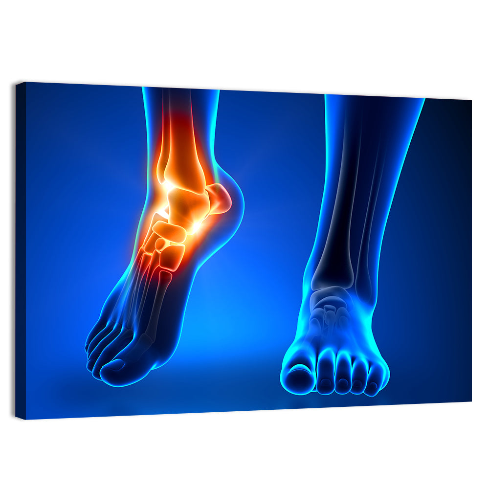 Ankle Pain Anatomy Wall Art, canvas print, landscape