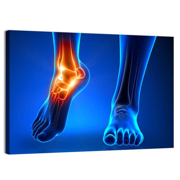 Ankle Pain Anatomy Wall Art as a canvas print