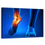 Ankle Pain Wall Art