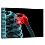 Lateral Shoulder X-ray Wall Art