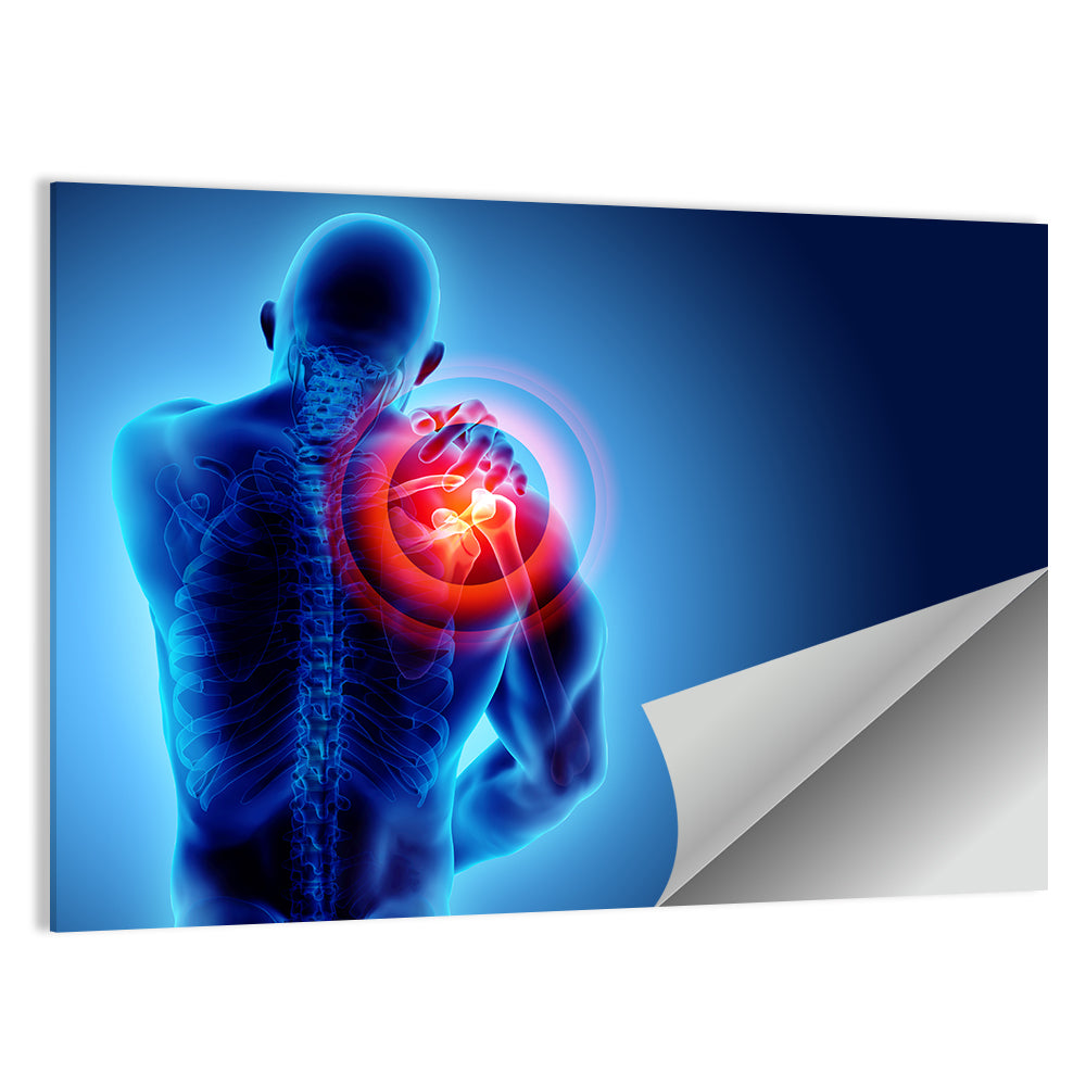 Shoulder Pain X-ray Wall Art