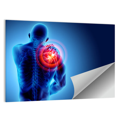 Shoulder Pain X-ray Wall Art