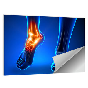 Ankle Pain Anatomy Wall Art