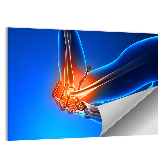 Elbow Joint Inflammation Illustration Wall Art as a poster print