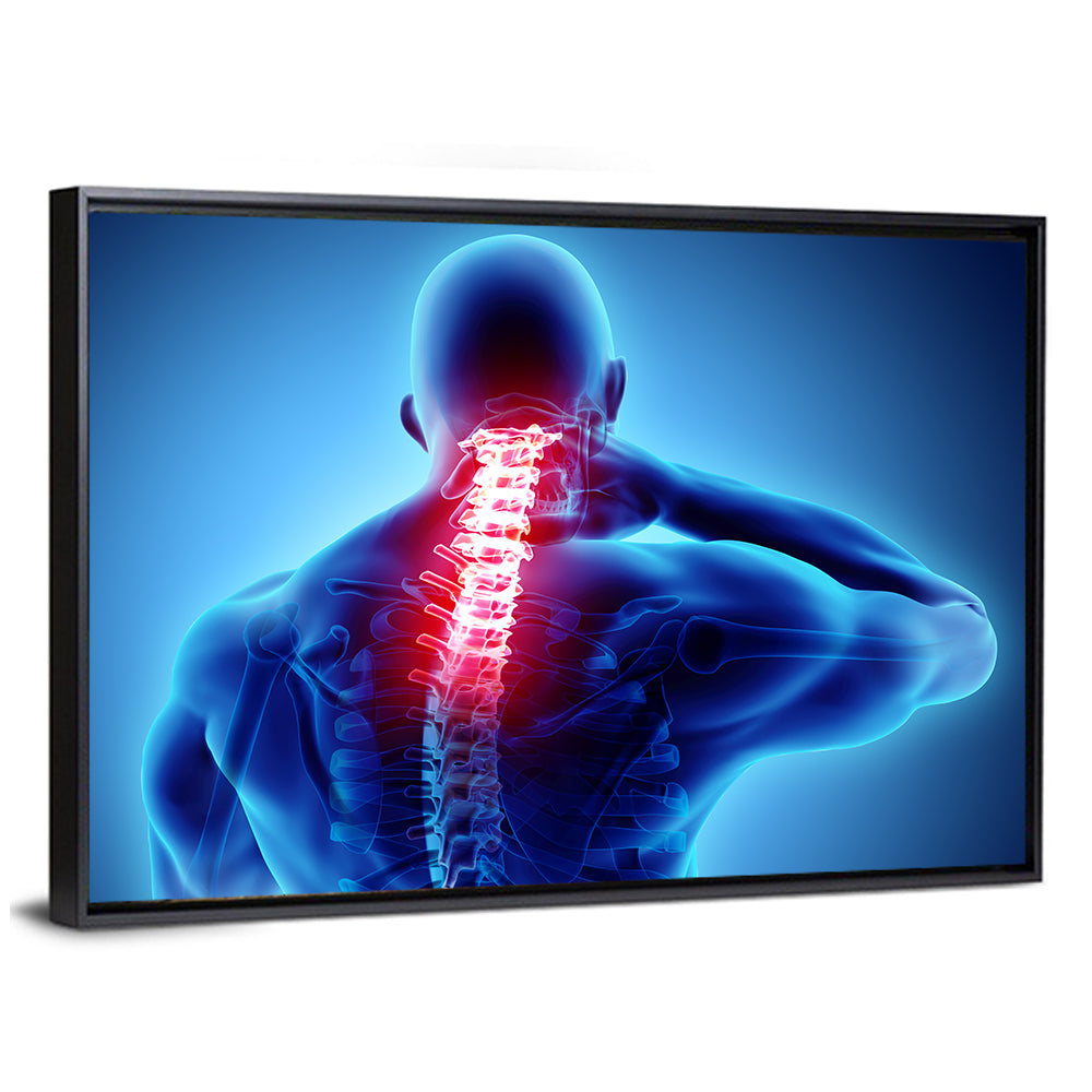 Cervical Spine X-ray Illustration Wall Art