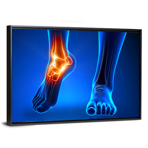 Ankle Pain Anatomy Wall Art