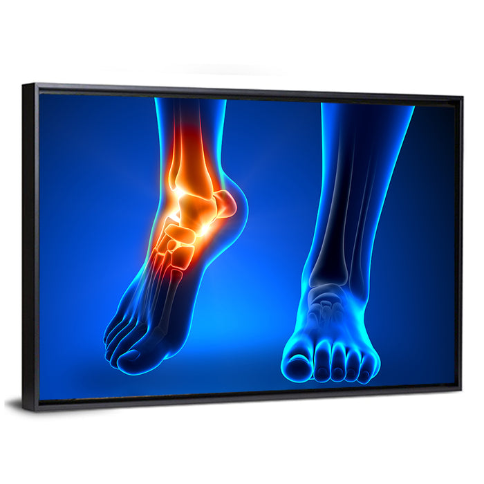 Ankle Anatomy X-ray Study Wall Art as a framed canvas