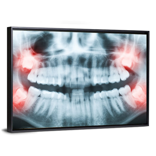 Dental X-ray Radiograph Wall Art