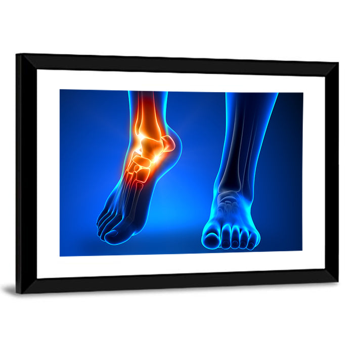 Ankle Anatomy X-ray Study Wall Art as a framed print