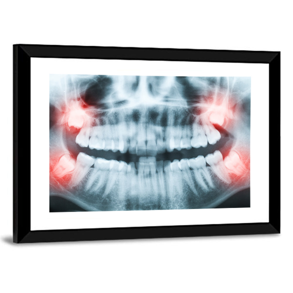 Dental X-ray Radiograph Wall Art