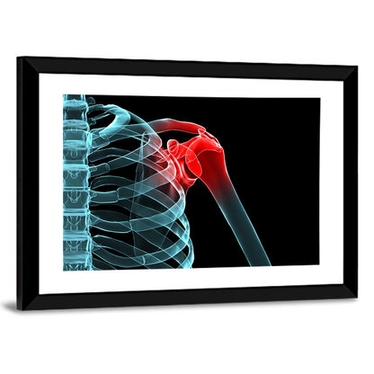 Lateral Shoulder X-ray Wall Art