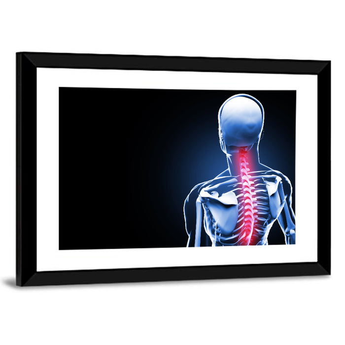 Spine Pain Anatomy Illustration Wall Art as a framed print