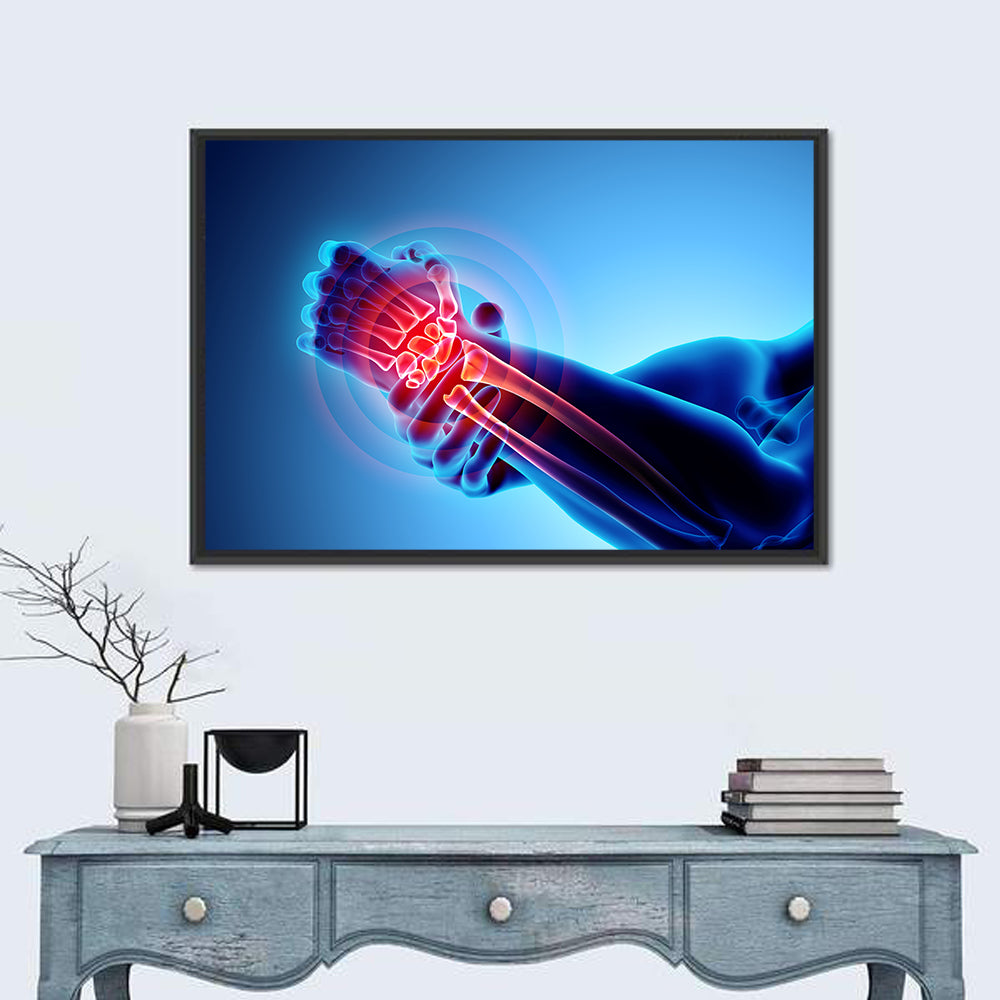 Painful Wrist X-ray Illustration Wall Art in a room, landscape