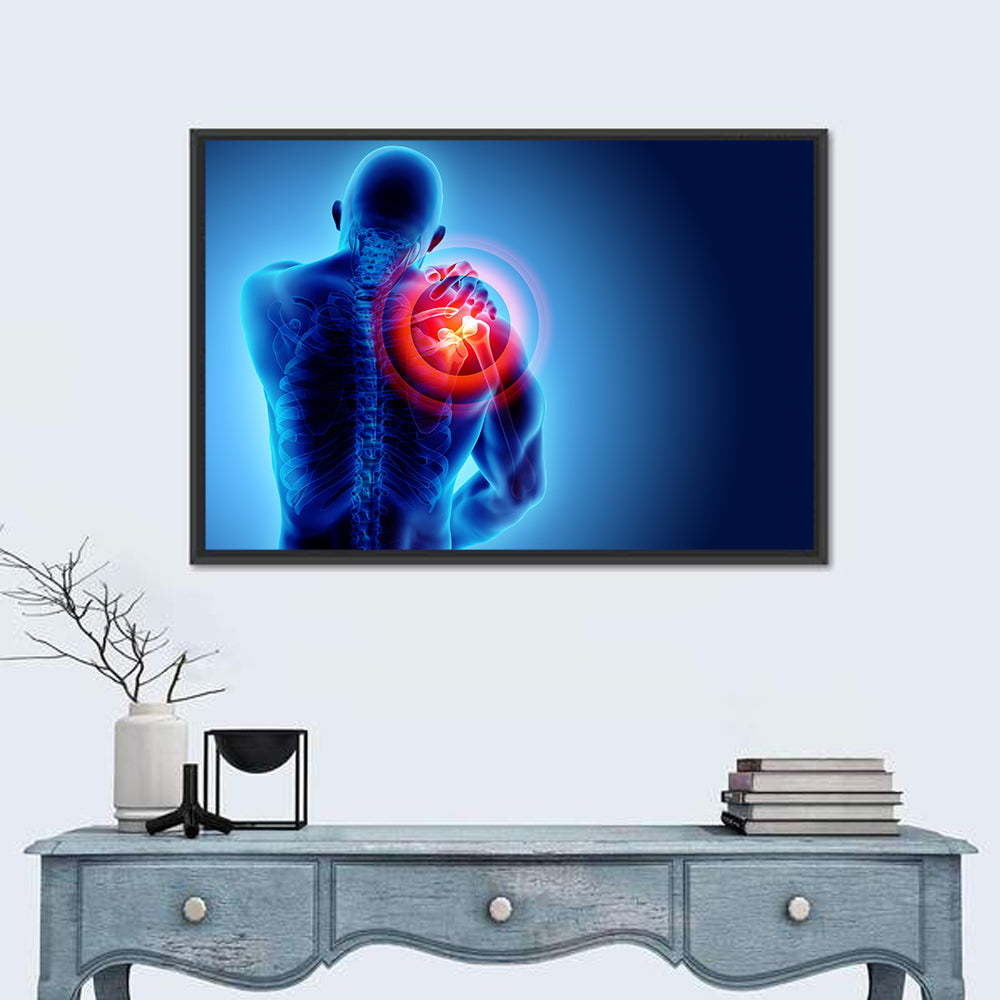 Shoulder Pain X-ray Wall Art in a room, landscape