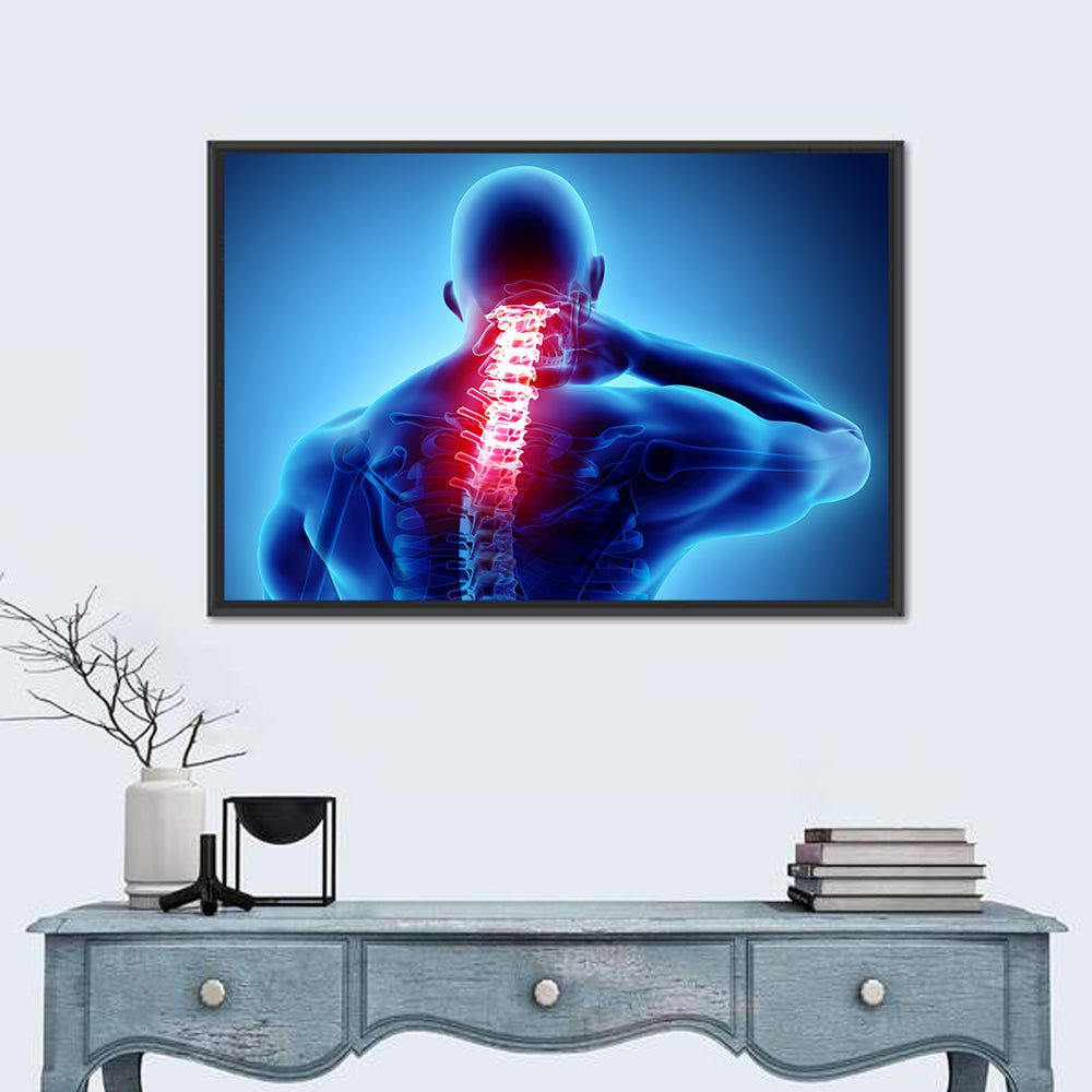 Cervical Spine X-ray Illustration Wall Art