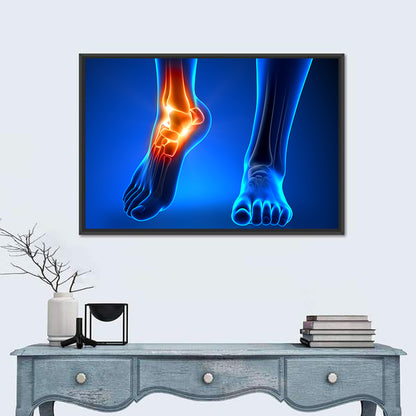 Ankle Anatomy X-ray Study Wall Art
