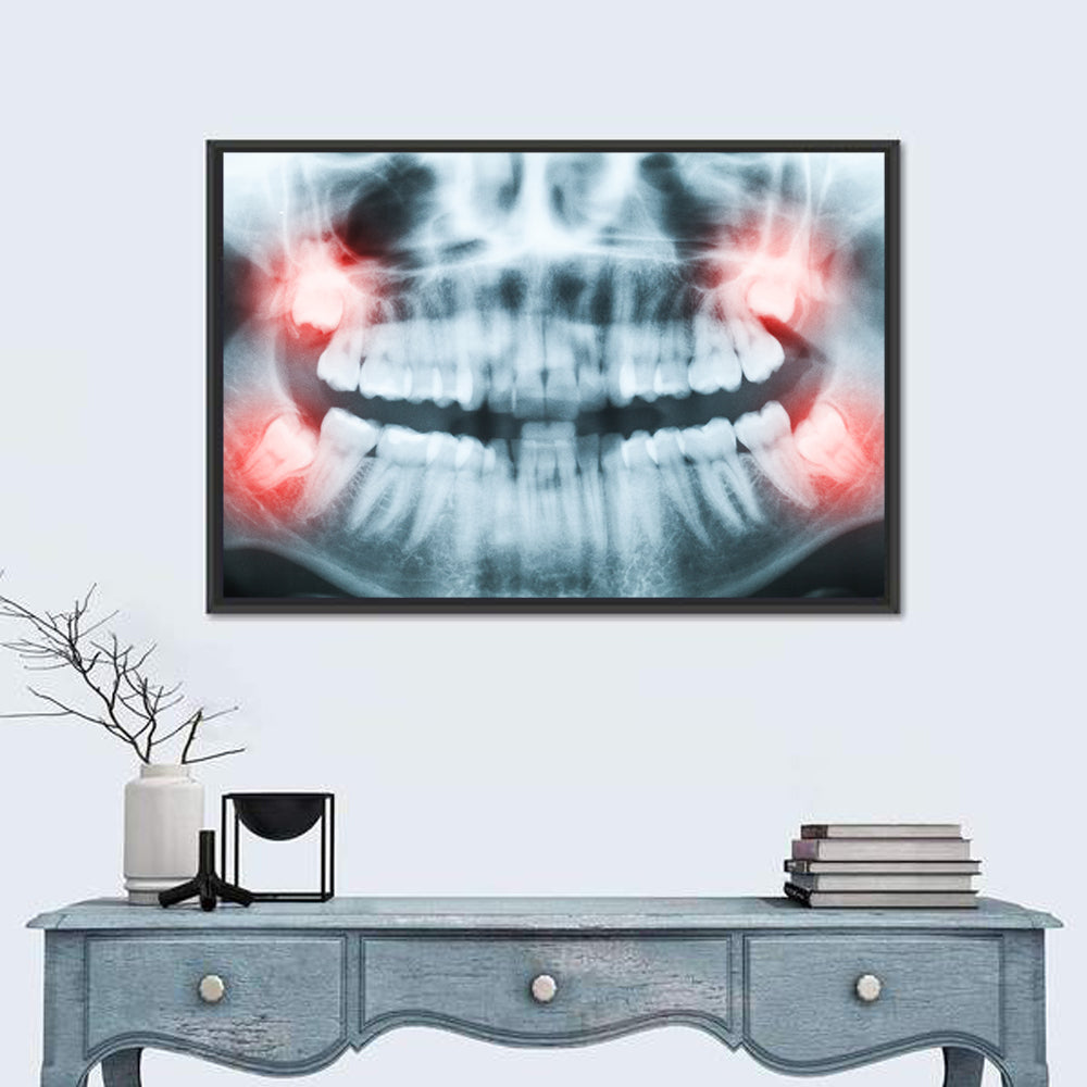 Dental X-ray Radiograph Wall Art in a room, landscape