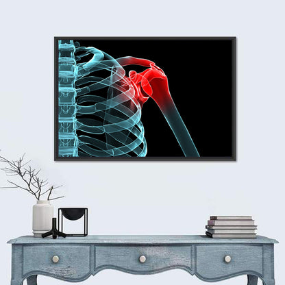 Lateral Shoulder X-ray Wall Art