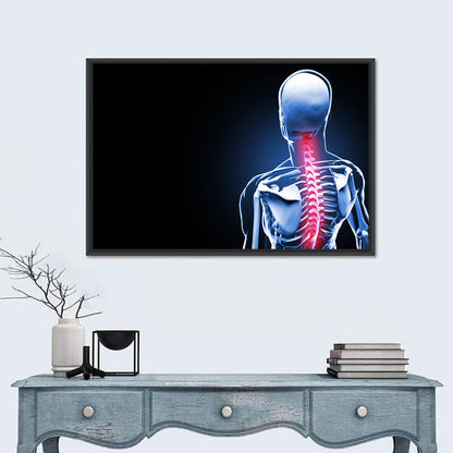 Spine Pain Anatomy Illustration Wall Art