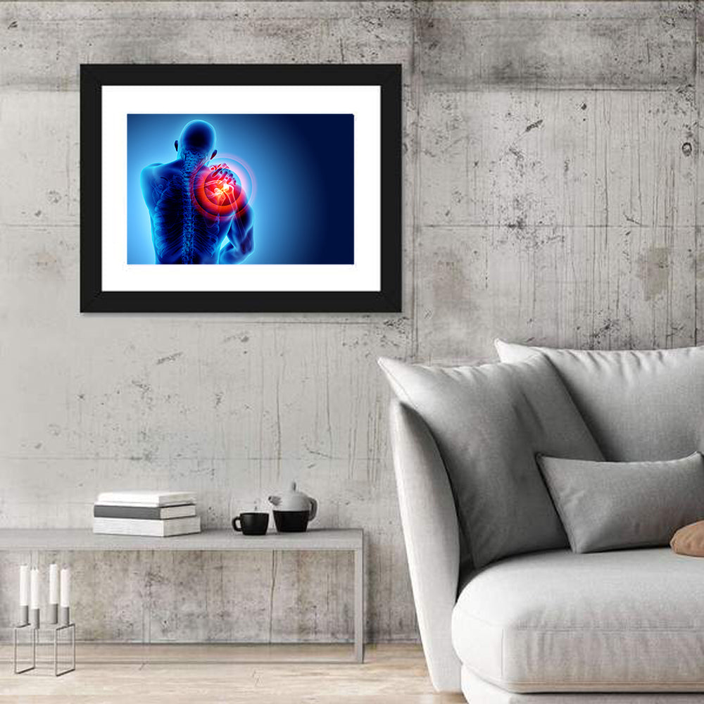 Shoulder Pain X-ray Wall Art in a room, landscape
