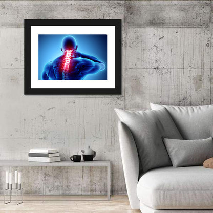 Cervical Spine X-ray Illustration Wall Art