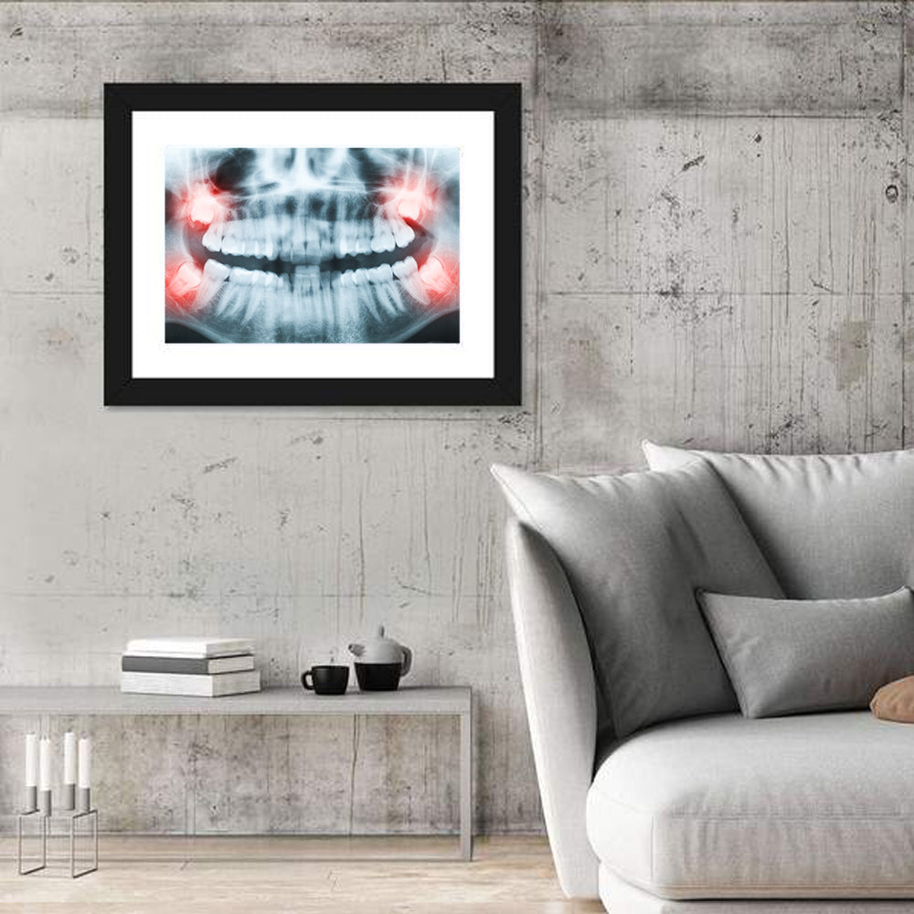 Dental X-ray Radiograph Wall Art