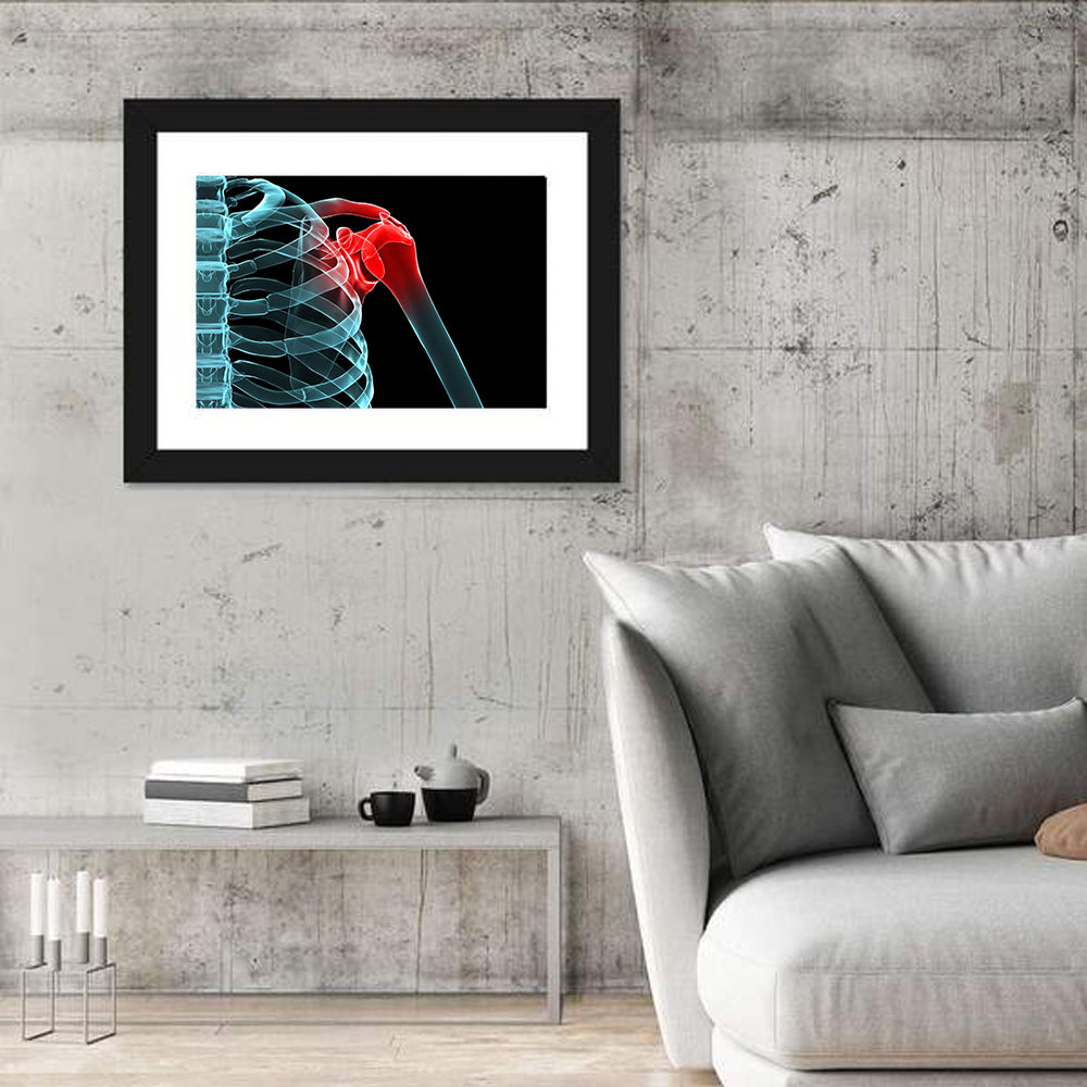Lateral Shoulder X-ray Wall Art in a room, landscape