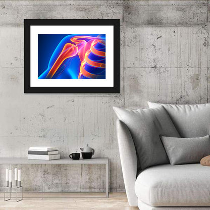 Shoulder Pain Anatomy Study Wall Art
