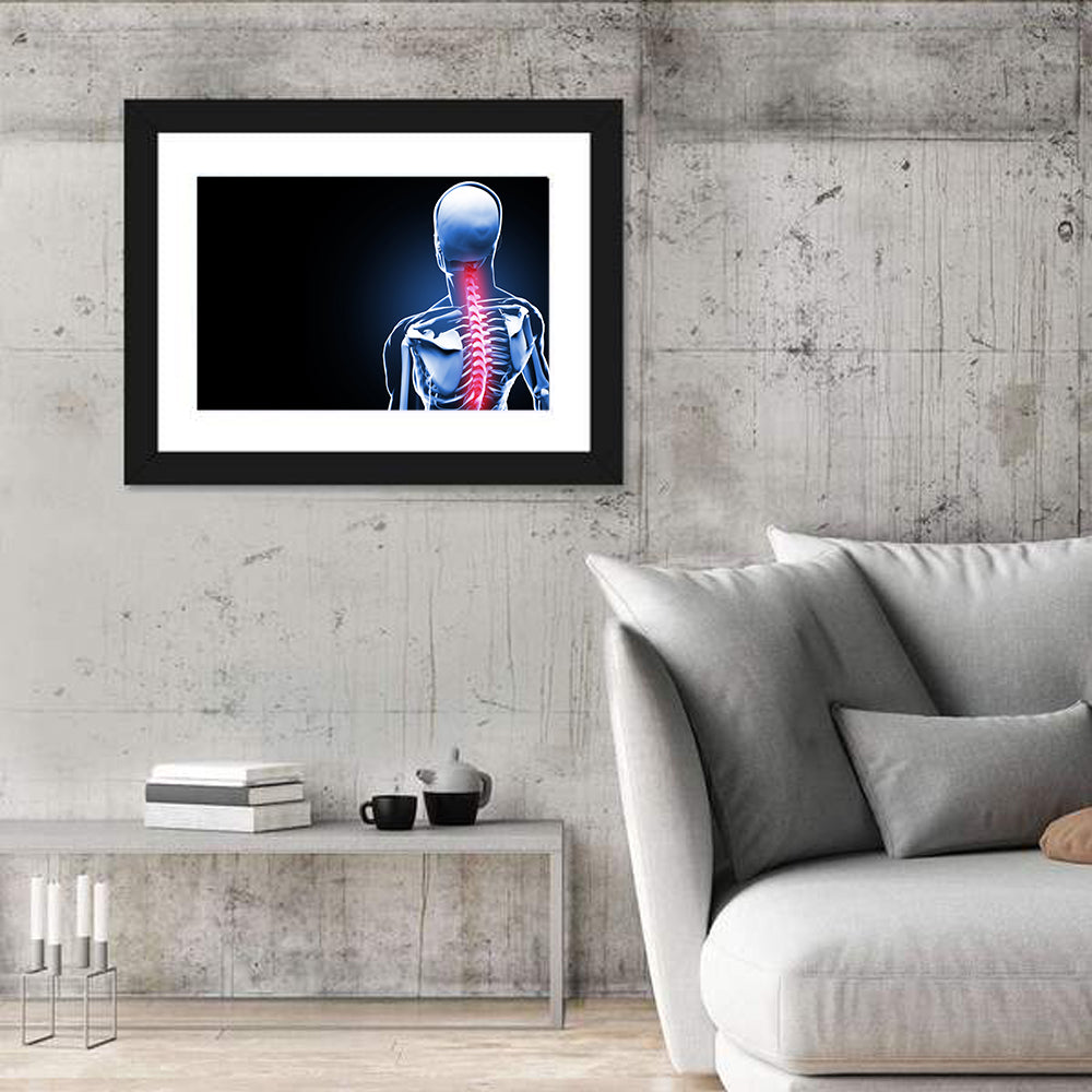Spine Pain Anatomy Illustration Wall Art in a room, landscape