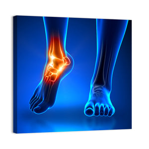 Ankle Pain Anatomy Wall Art