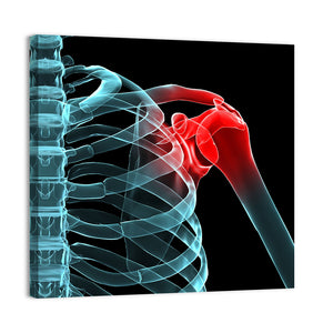 Painful Shoulder X Ray Wall Art