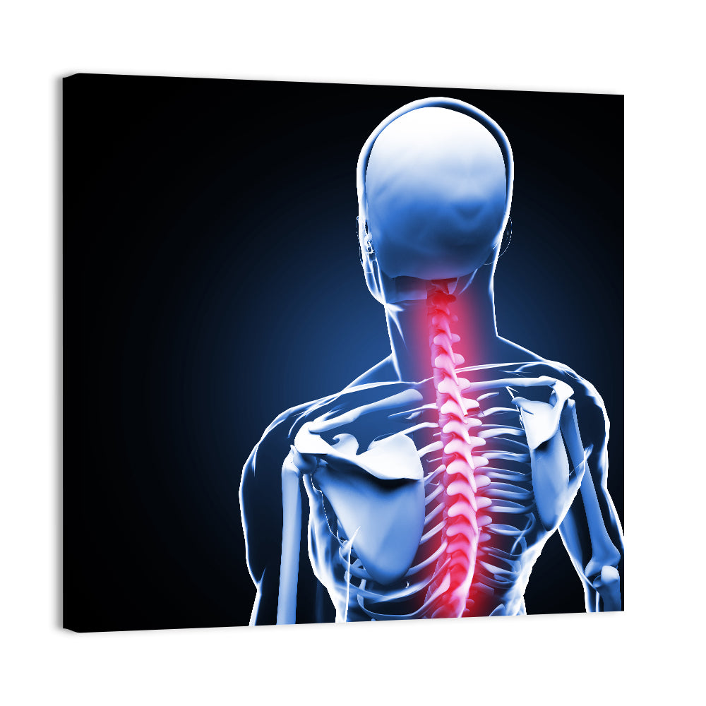 Spine Pain Anatomy Illustration Wall Art