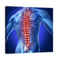 Spine Pain Anatomy Illustration Wall Art