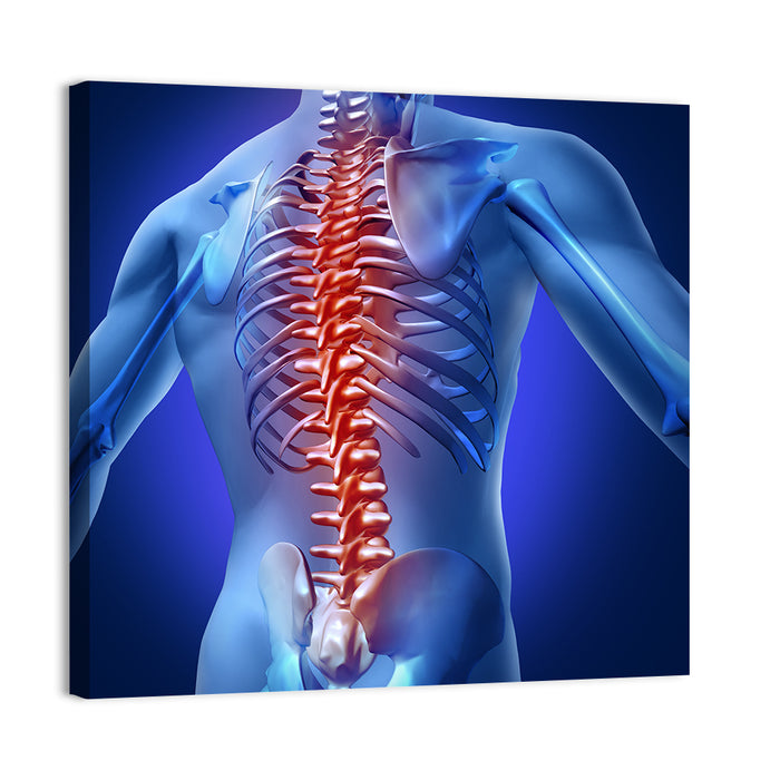 Spine Pain Anatomy Illustration Wall Art as a canvas print