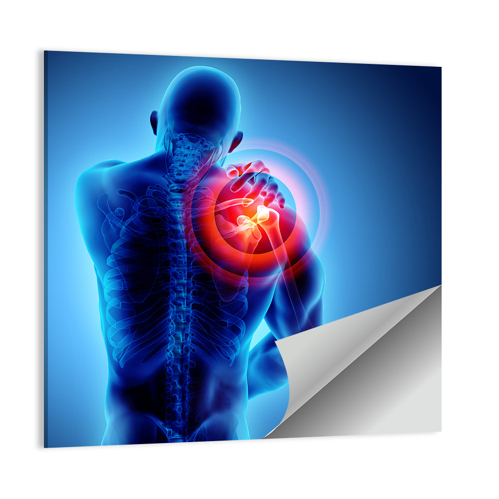 Shoulder Pain X-ray Wall Art