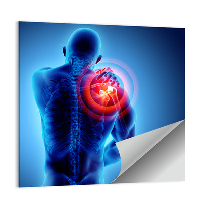 Shoulder Pain X-ray Wall Art
